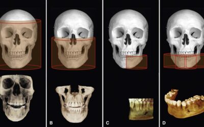 Learning the Terms In CBCT Part 4 – From P to Z