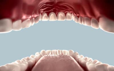 CoVid-19 In the Oral Cavity