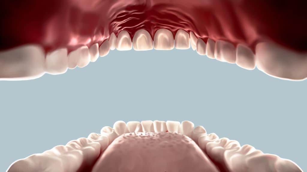 CoVid-19 In the Oral Cavity